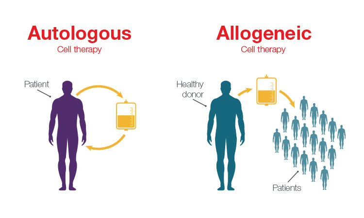 Comparison between autologous therapies and allogeneic therapies